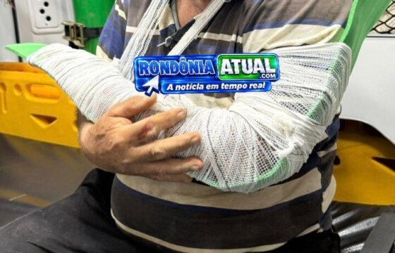 Motociclista fica ferido após perder o controle e sofrer violenta queda na Linha 128, em Ji-Paraná