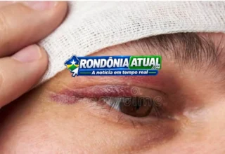Ji-Paraná – mulher é enforcada, homem leva socão no olho e os dois são detidos pela Polícia