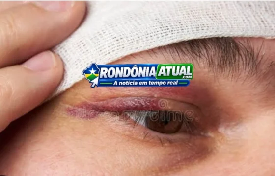 Ji-Paraná – mulher é enforcada, homem leva socão no olho e os dois são detidos pela Polícia