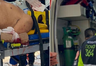 Idoso é atropelado por caminhão na BR-364, fica em estado grave e é intubado