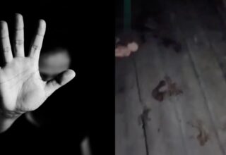 IMAGENS FORTE: Após discussão com ex-marido, mulher tem mão decepada por facão; veja vídeo