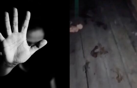 IMAGENS FORTE: Após discussão com ex-marido, mulher tem mão decepada por facão; veja vídeo